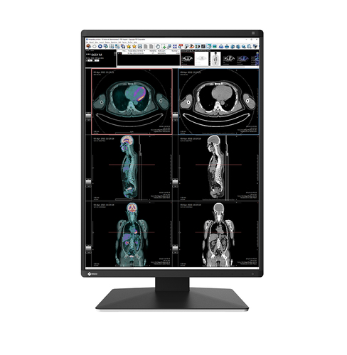 EIZO RadiForce RX370 computer monitor 54.1 cm (21.3") 1536 x 2048 pixels LCD Black